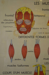Mid Century French Medical Poster